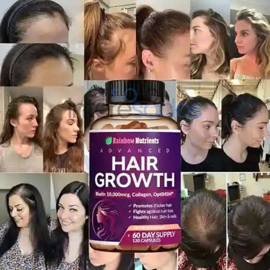 Biotina Hair Growth – Fortalece tu cabello y devolvéle su brillo natural (30 cápsulas)