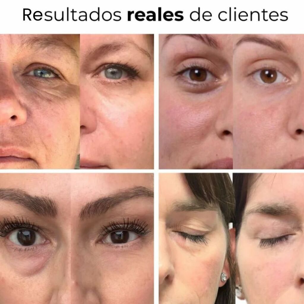2X1/ Parches PuraDerma™ Firmeza y Elevación